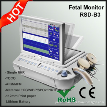 Maternal SPO2/NIBP/ECG/TEMP/RESP Monitoring Multi Parameter Fetal Monitor